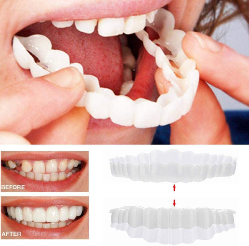 Smile Veneer Set - Complete Upper & Lower Teeth Coverage for a Perfect Smile
