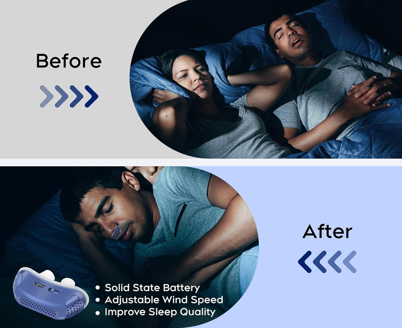 Portable Micro CPAP Sleep Apnea Machine - Travel-Friendly Anti-Snoring Solution | Compact CPAP Alternative