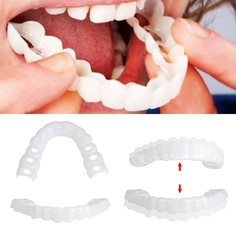 Smile Veneers Set - Premium Upper & Lower Cosmetic Dental Veneers for a Perfect Smile