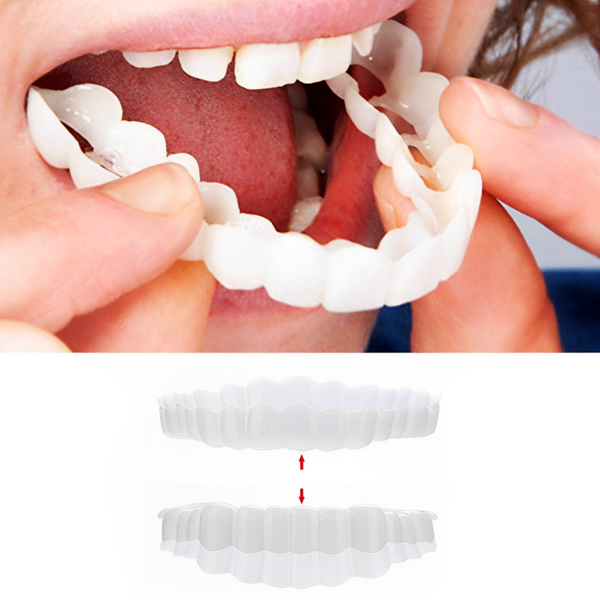 Smile Veneer Set - Complete Upper & Lower Teeth Coverage for a Perfect Smile