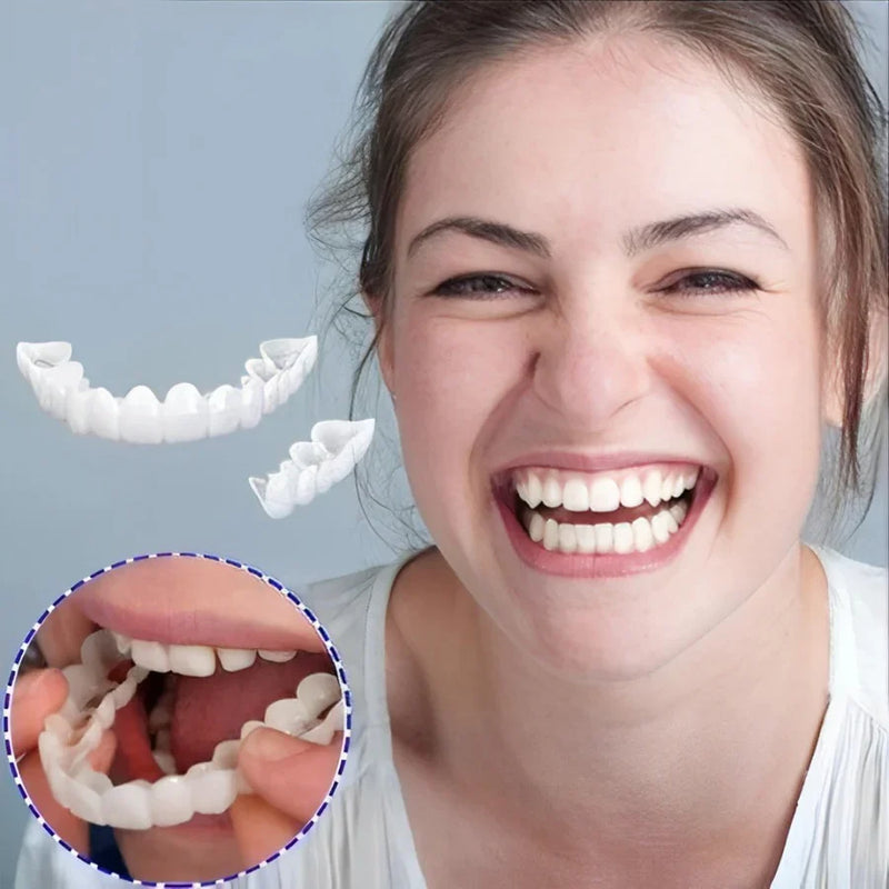 Smile Veneers Set - Premium Upper & Lower Cosmetic Dental Veneers for a Perfect Smile