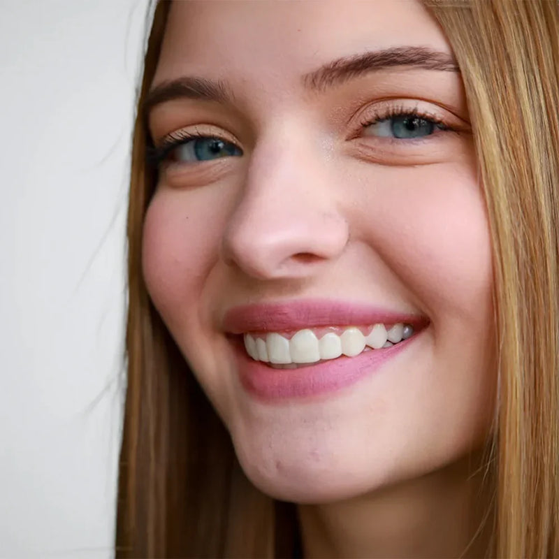 Smile Veneers Set - Premium Upper & Lower Cosmetic Dental Veneers for a Perfect Smile