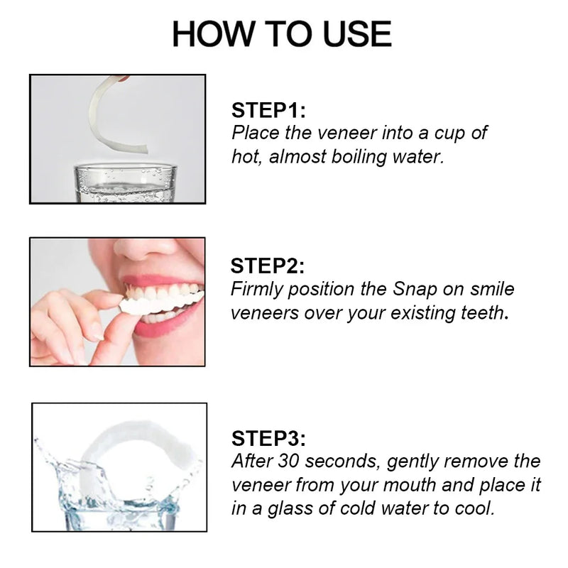 Smile Veneers Set - Premium Upper & Lower Cosmetic Dental Veneers for a Perfect Smile