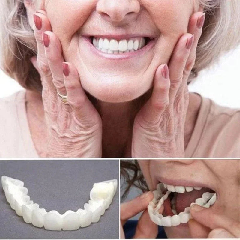 Smile Veneers Set - Premium Upper & Lower Cosmetic Dental Veneers for a Perfect Smile
